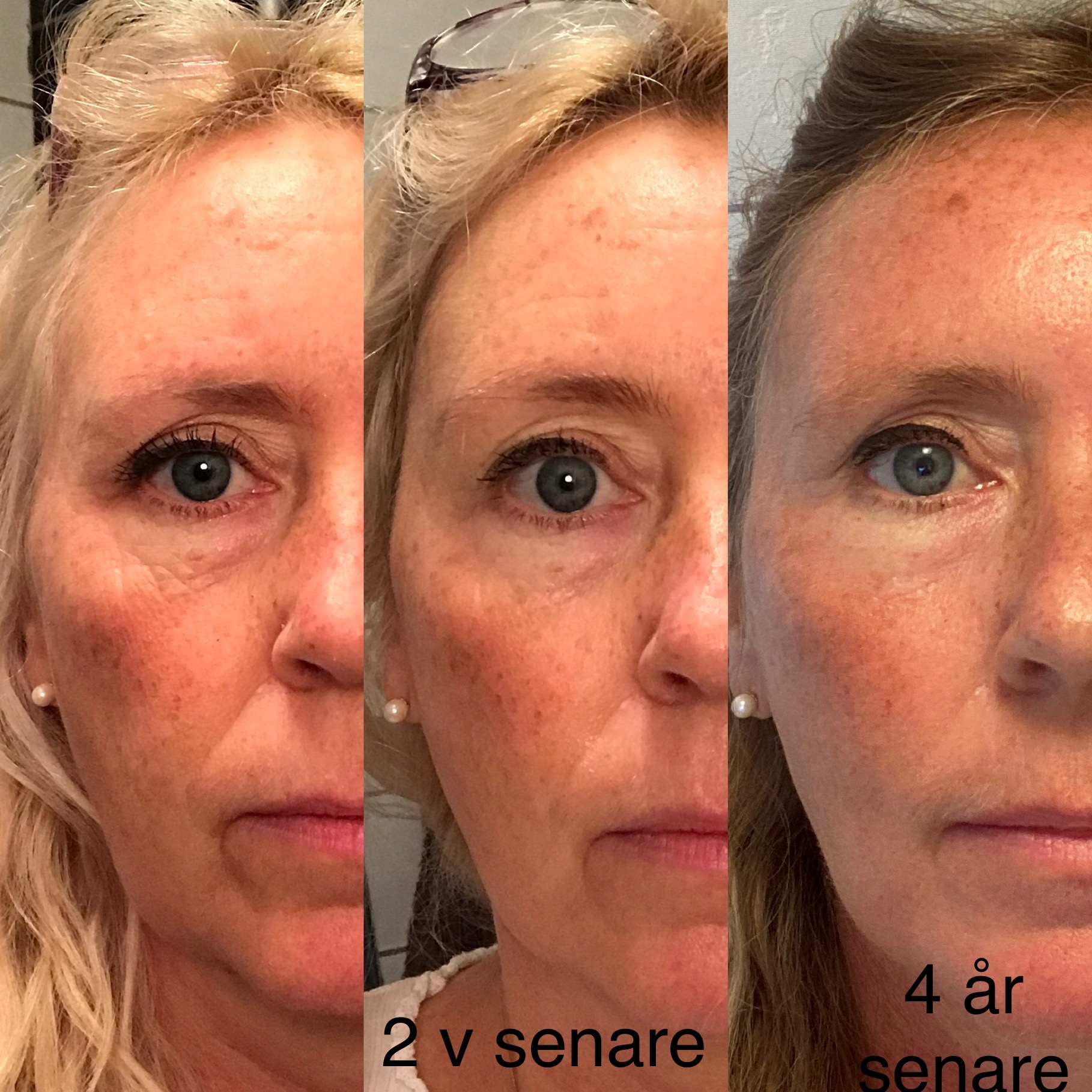 Firming Mask